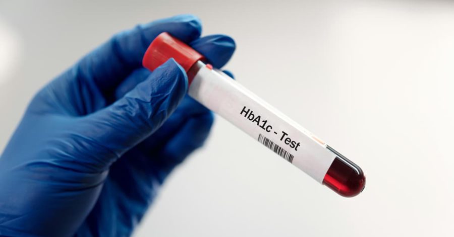 Prueba HbA1c